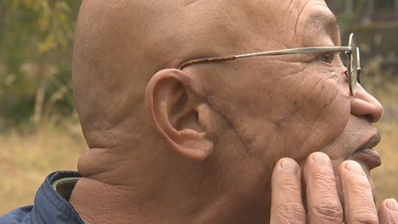 クマに襲われた時の傷