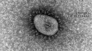 87人の新型コロナ感染を確認 病床使用率は約3割に<福島県1月19日公表>
