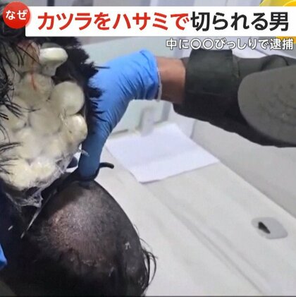 【なぜ】カツラをハサミで切られる男…中に約160万円分の“大量コカイン”　空港の身体検査・スキャナーで判明し逮捕　コロンビア