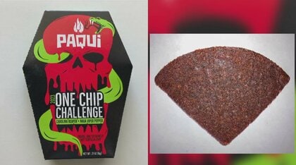 “激辛”は食道や胃腸からの出血に。アメリカで「激辛チップス」食べた14歳少年が死亡。子どもへのリスクに医師が警鐘を鳴らす