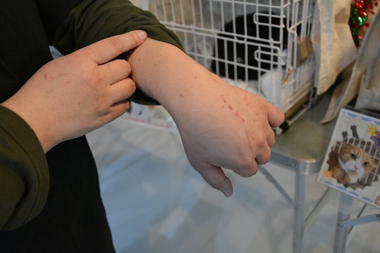 譲渡会場に搬入するため猫を捕まえる際に引っかかれた傷