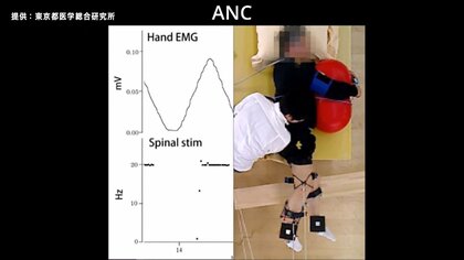 脊髄損傷部分を迂回し神経回路に信号伝達　自分の意思で足を動かす実験に成功　「人工神経接続システム」で新たなリハビリ手法の可能性も