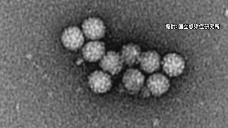ノロウイルスで14人が感染 長野県佐久市の飲食店 県は改めて感染予防策呼びかけ|FNNプライムオンライン