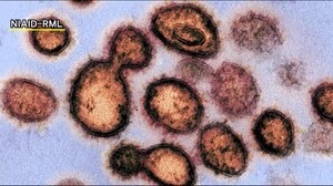 22人の新規感染 うち5人がクラスター発生の病院関連 12月20日《福島県・新型コロナ》