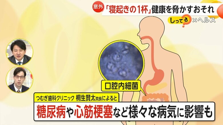 心筋梗塞など様々な病気に影響を及ぼすという「口腔内細菌」