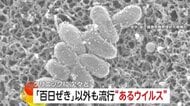 「百日咳患者」子供中心に過去最多更新する一方、大人にも強い感染力「アデノウイルス」流行に要注意…アルコール消毒効きにくく特効薬なし風呂で感染も