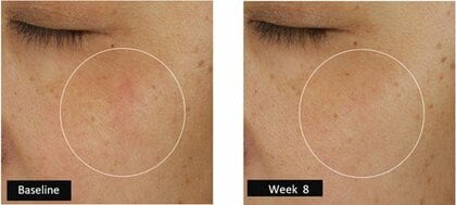 睡眠の日に寄せて ― エスティ ローダー、初の「睡眠不足者」のみを対象としたスキンケア臨床試験結果を発表。
