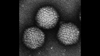 子どもが原因不明の肝炎に感染する報告相次ぐ…169例のうち74例でアデノウイルス検出