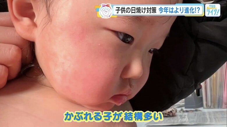 顔や腕など、かぶれやすい子どもの肌