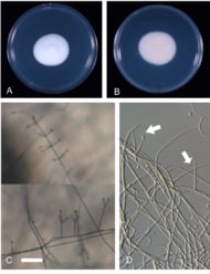 【国立科学博物館】植物病原菌が多く知られるバッカクキン科の菌類が両生類に病気を起こすことを実証