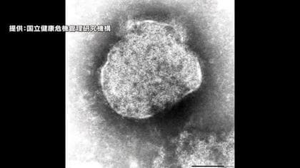 【注意】岡山市で１歳男児と３０代父親が「はしか」に感染　２人とも快方に　感染者は前年の約６倍【岡山】