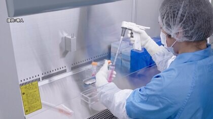 iPS細胞“健康なうちに”長期保存　国内初個人向けサービス開始へ