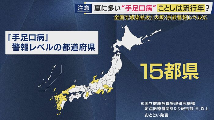 手足口病の警報レベルは15都県(7日に発表した速報値)