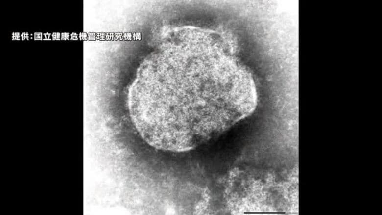 宝塚歌劇団が“はしか”感染に注意呼びかけ…1月20日の東京公演を“はしか”との診断受けた観客が観劇｜FNNプライムオンライン