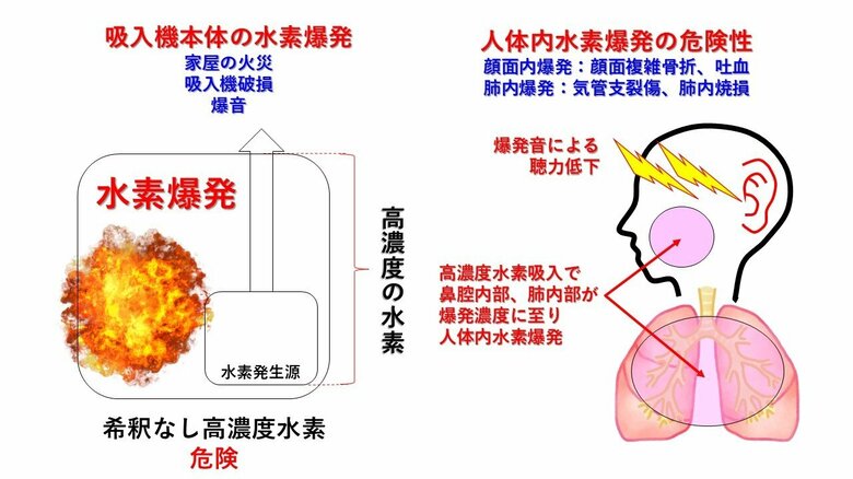 MiZ株式会社「高濃度水素吸入器による人体内水素爆発事故」に関する学術論文を公開　-安全な「低濃度水素療法」への転換を提言 -