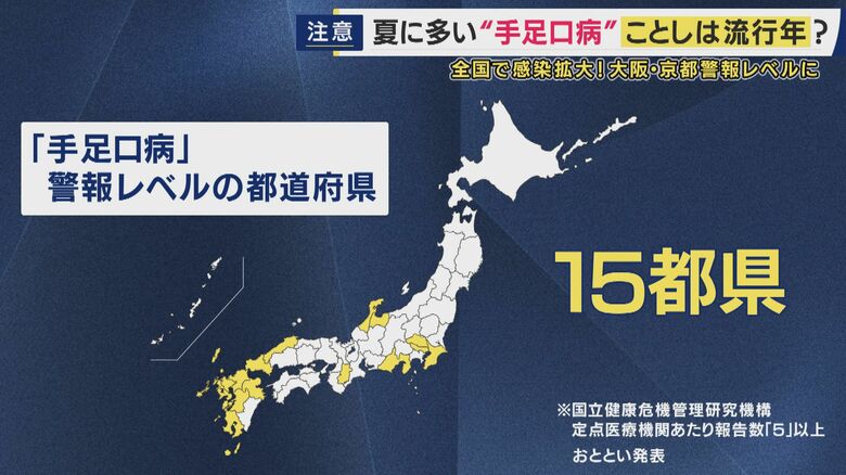 手足口病の警報レベルは15都県（7日に発表した速報値）