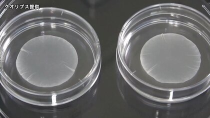 世界初iPS細胞製品 3月上旬にも承認へ　上野厚労相「患者さんの手元に早く届くことを期待」