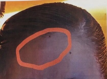 深夜11時51分「まだかえれん」メッセージ…宝塚女性死亡の遺族側がSNS公開　ヘアアイロン「やけど」写真も