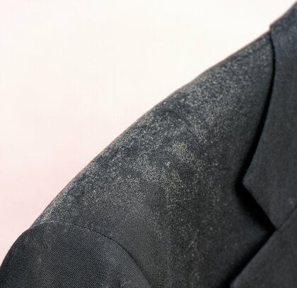 スーツについた白カビ（画像はイメージ）