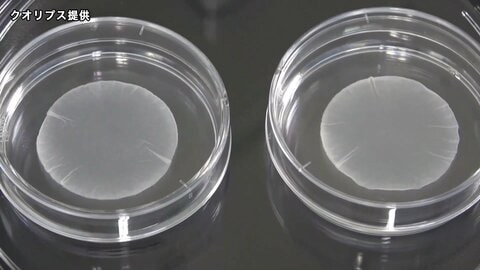 世界初iPS細胞製品 3月上旬にも承認へ　上野厚労相「患者さんの手元に早く届くことを期待」