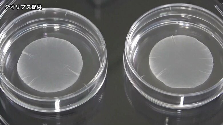 世界初iPS細胞製品 3月上旬にも承認へ　上野厚労相「患者さんの手元に早く届くことを期待」｜FNNプライムオンライン