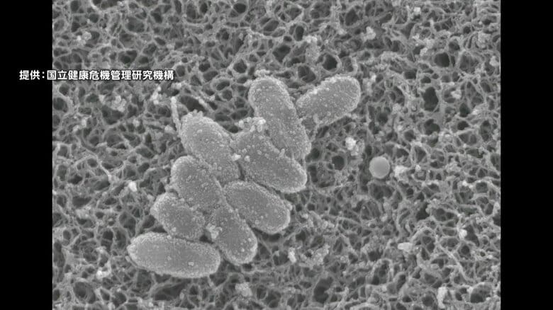 「百日咳」新規感染者数は2970人…2週間ぶりに減少も依然高い水準　「リンゴ病」新規感染者数も2週間ぶり減少｜FNNプライムオンライン