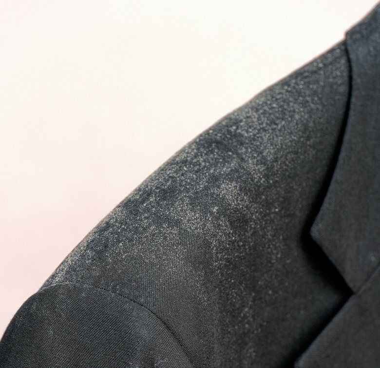 スーツについた白カビ（画像はイメージ）