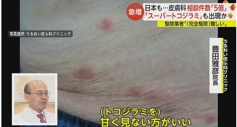 「命に関わる危険も。甘く見ない方がいい」と警鐘を鳴らす