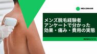 メンズ脱毛経験者アンケートで分かった効果・痛み・費用の実態