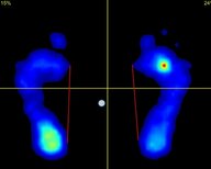 現代の子どもの8割が「浮き指」に!? コロナ禍の生活で拍車。大人になってから痛み・しびれも…予防法を聞いた