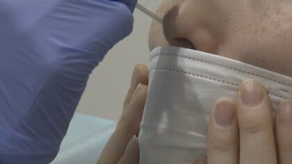 インフルエンザB型が猛威　富山県で3週連続増加、「吐き気、おう吐、下痢など」 胃腸症状が特徴的