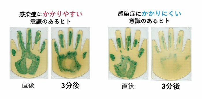 感染症にかかりやすい意識のあるヒトとかかりにくい意識のあるヒトの手指バリアの違い(画像提供:花王)