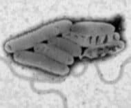 レジオネラ菌で集団感染か_名寄保健所管内などで21人が体調不良を訴え_患者からレジオネラ菌検出_多くが市内の施設を利用するも感染場所はまだ特定できず_エアロゾルの吸引で感染_北海道