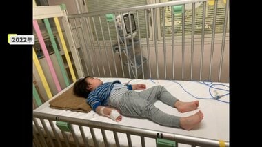 「かゆい、かゆい」3歳が耳かき一杯で救急搬送　“重症化”しやすいナッツアレルギー　外…