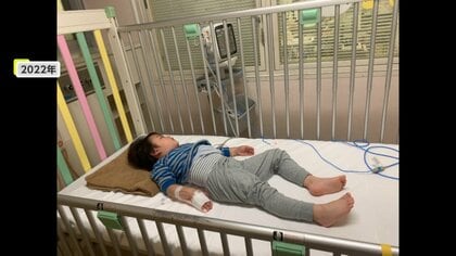 「かゆい、かゆい」3歳が耳かき一杯で救急搬送　“重症化”しやすいナッツアレルギー　外食に潜むリスクと支える家族