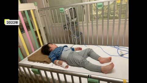 「かゆい、かゆい」3歳が耳かき一杯で救急搬送　“重症化”しやすいナッツアレルギー　外食に潜むリスクと支える家族【2025年度の読まれた記事】