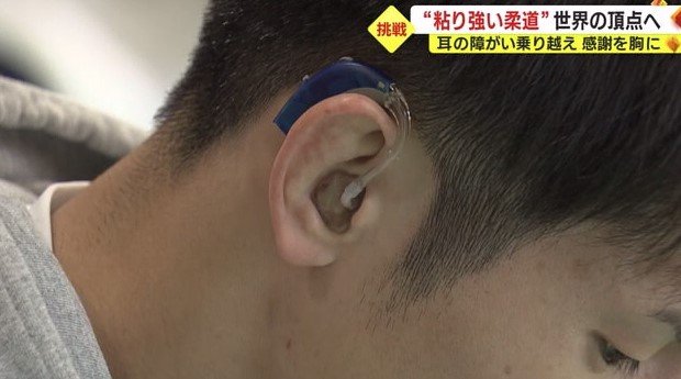 佐藤選手が耳につける補聴器