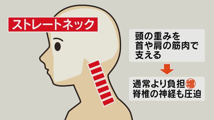 ストレートネックの場合は…