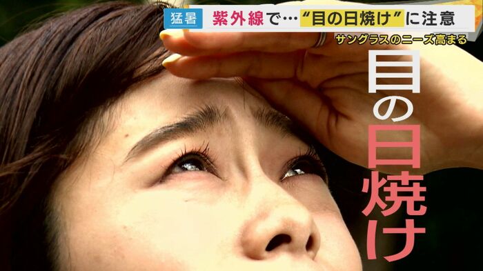 “目の日焼け”に注意したい