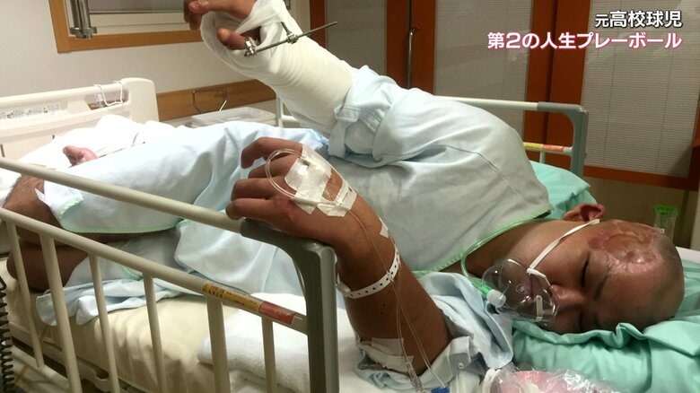 事故で九死に一生を得た浅野さん