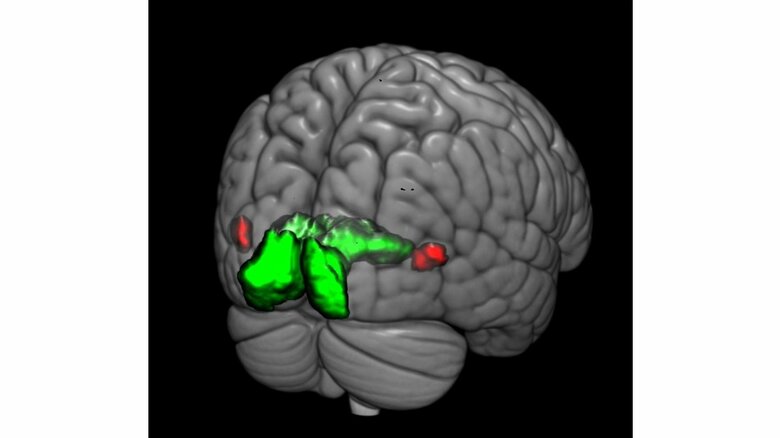 実験中の脳を後ろから見た図。赤い部分が「hMT」（画像提供：NICT）
