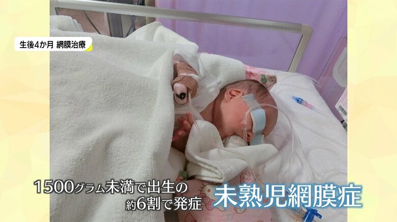 生後4カ月 網膜治療の様子