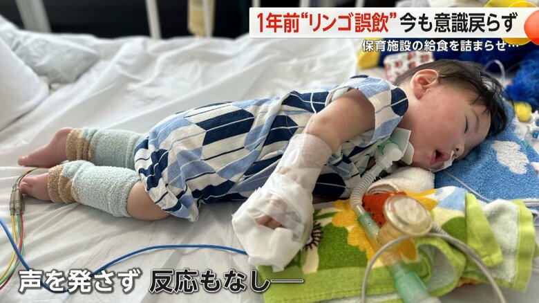 愛媛県の保育園でりんごを詰まらせ、今も意識不明のままの康至くん