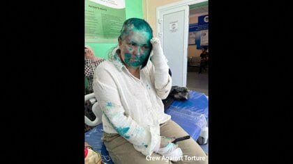 反体制メディアの女性記者襲われ丸刈りに　ロシア・チェチェン共和国で裁判取材中