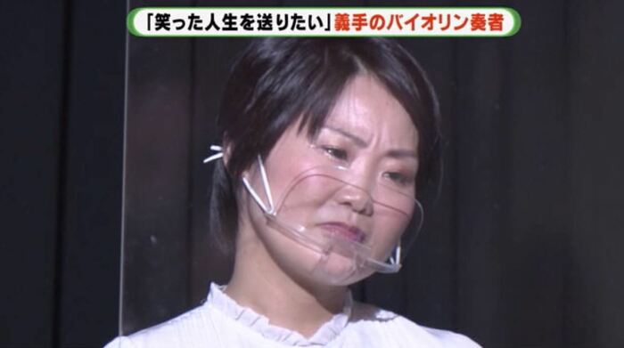 講演で右腕切断の経緯を語る伊藤さん