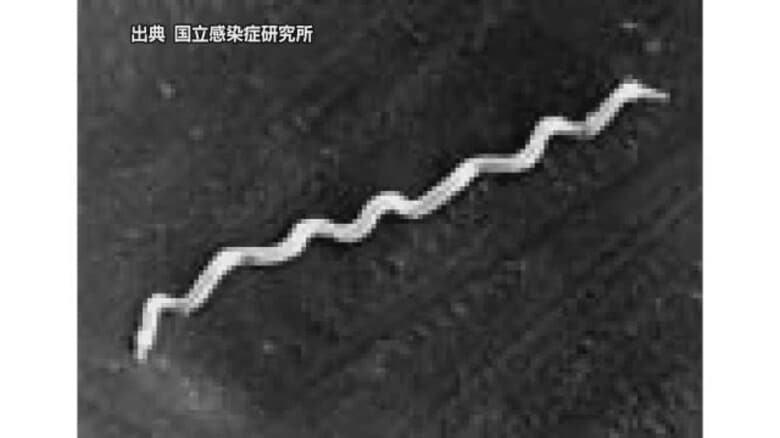愛媛の今年の梅毒感染　男性は過去５年最多上回るペース　半数が性風俗産業利用　コンドーム利用を【愛媛】｜FNNプライムオンライン