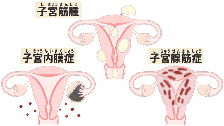 （画像はイメージ）