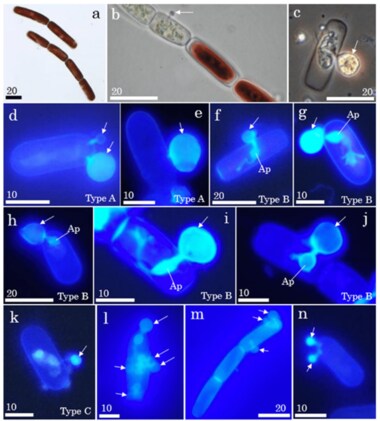 氷河で繁殖している藻類に高い感染率でツボカビが寄生していることを発見