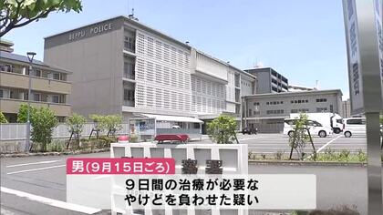 子供3人を虐待か　父親（31）を逮捕　高温のライターの金属部分を押しつけやけどを負わせた疑い　大分