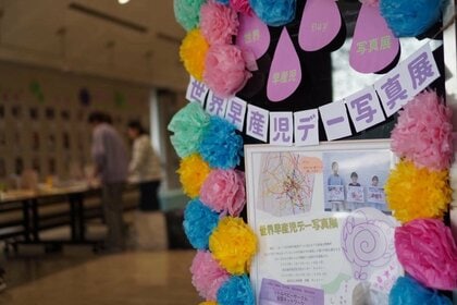 「リトルベビー」のことをもっと知ってほしい　小さく生まれてきた赤ちゃんの写真展開催中　広島